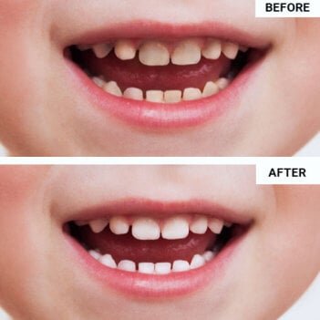 WellaWhite Electric Toothbrush user Lee S.